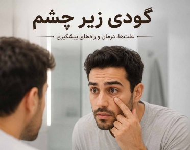 درمان گودی زیر چشم