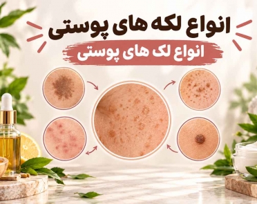 انواع لکه های پوستی