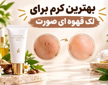 بهترین کرم برای لک قهوه ای صورت