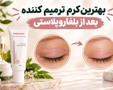 بهترین کرم ترمیم کننده بعد از بلفاروپلاستی